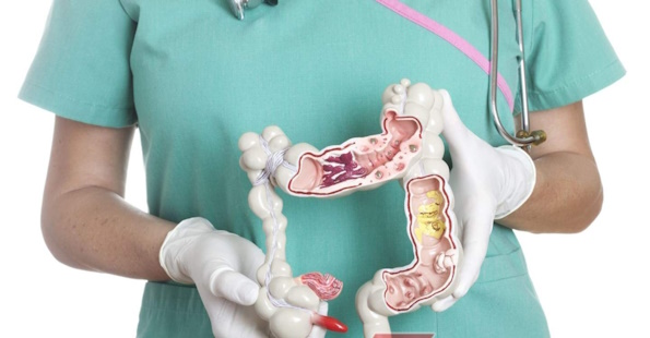 Колоректальний рак